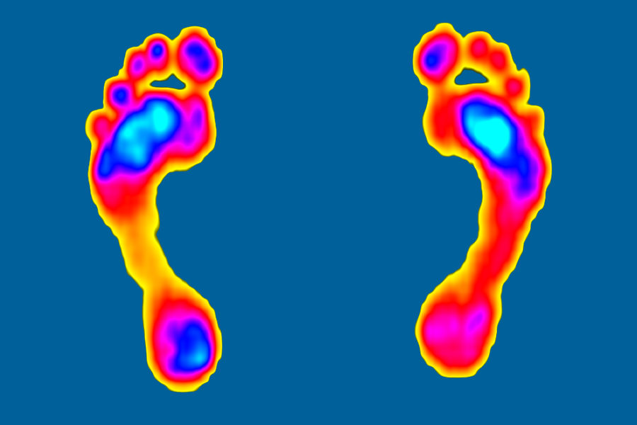 Gait Analysis & Biomechanics