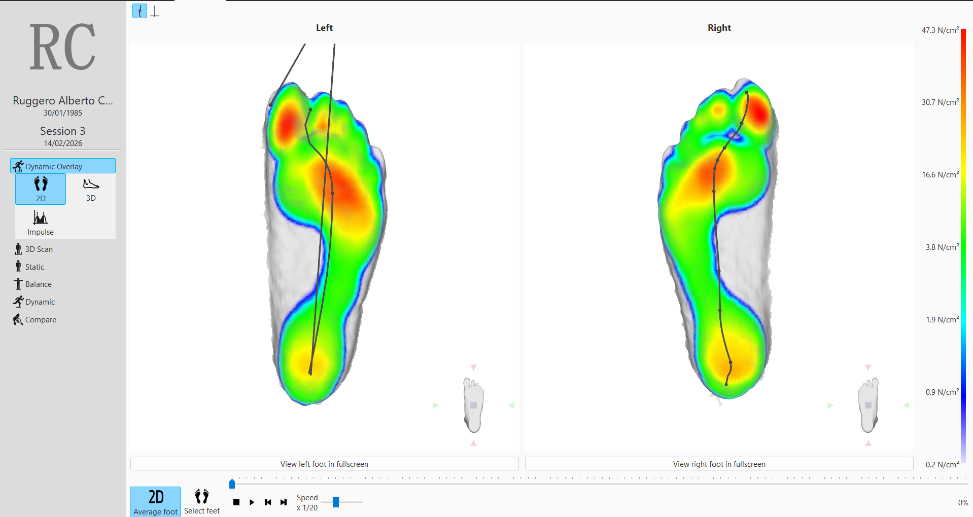 Coastal Podiatry - GAIT ANALYSIS FOR COMFORT AND INJURY PREVENTION